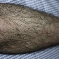 有腿毛的女生图片 (11)